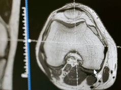 Cienki implant pozwala badać aktywność kilku obszarów mózgu jednocześnie