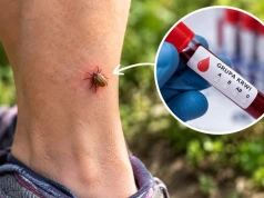 Masz tę grupę krwi? Kleszcze atakują ją najczęściej