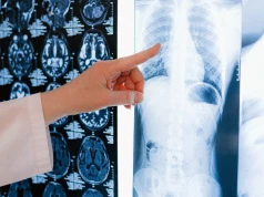 Wirtualne guzy raka płuca pomagają szukać nowych kombinacji leczenia