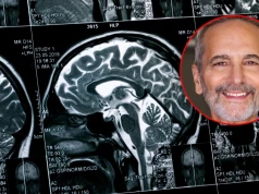 Uznany amerykański neurobiolog i psychiatra zdradza cztery proste nawyki, które pomagają chronić starzejący się mózg
