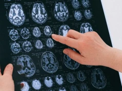 Udar może zwiększać ryzyko glejaka. Naukowcy odkryli mechanizm łączący uraz mózgu z nowotworem